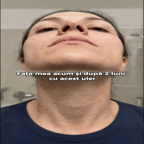 CyperusBIO –Ulei pentru Indepartarea Parului